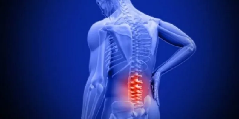 thoát vị đĩa đệm