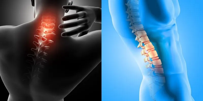 thoát vị đĩa đệm